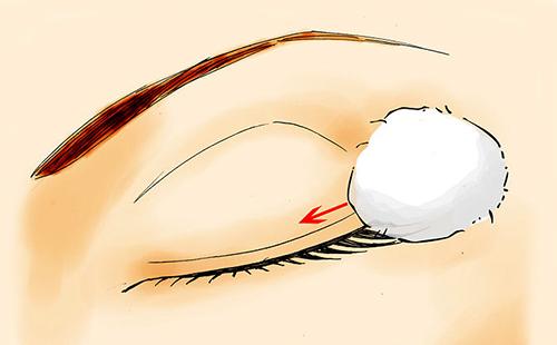 Come rimuovere la colla dalle palpebre