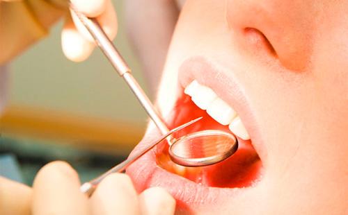العلاج عند طبيب الأسنان