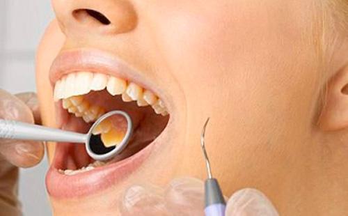 التبييض عند طبيب الأسنان