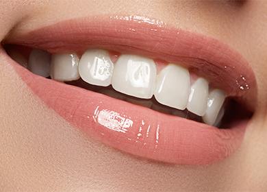 أسنان بيضاء جميلة