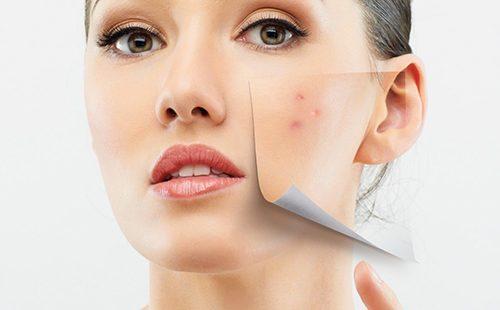 Una ragazza rimuove un'area problematica della pelle dal viso, come un pezzo di carta
