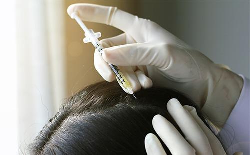 Scalp injection