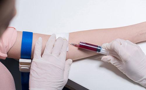Krevní test z žíly